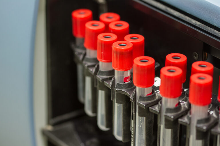 PRP Protein Rich Plasma Arthritis and Osteoporosis Associates